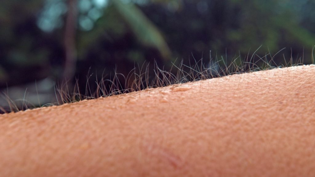 opioid withdrawal timeline may include symptoms like goosebumps and cold flushes