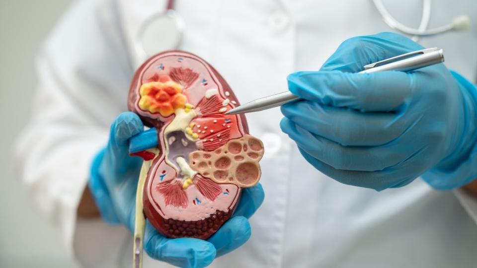 How Does Liquor Affect Kidneys? a man pokes around in a model of a kidney.